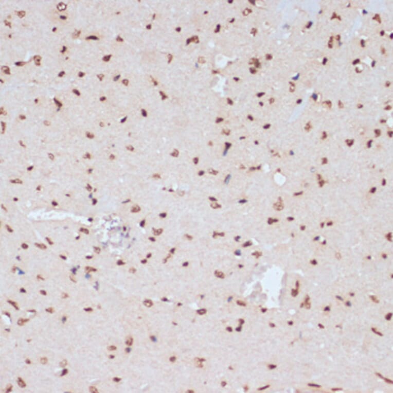 Immunohistochemistry - Anti-ERK1 (phospho Tyr204) Antibody (A16536) - Antibodies.com