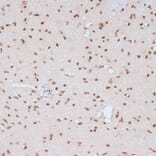 Immunohistochemistry - Anti-ERK1 (phospho Tyr204) Antibody (A16536) - Antibodies.com