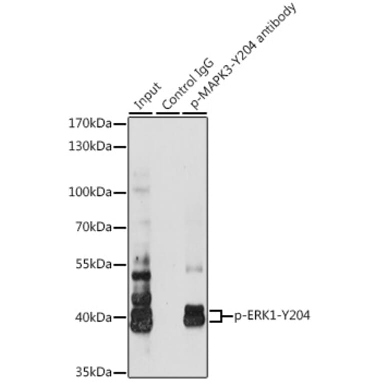 Western Blot - Anti-ERK1 (phospho Tyr204) Antibody (A16536) - Antibodies.com