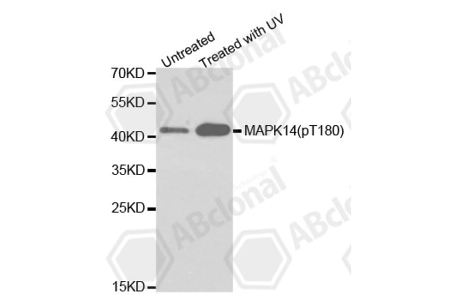 Western Blot - Anti-MAPK14 (phospho T180) Antibody (AP0238) - Antibodies.com
