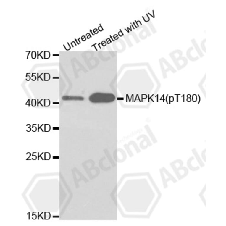 Western Blot - Anti-MAPK14 (phospho T180) Antibody (AP0238) - Antibodies.com
