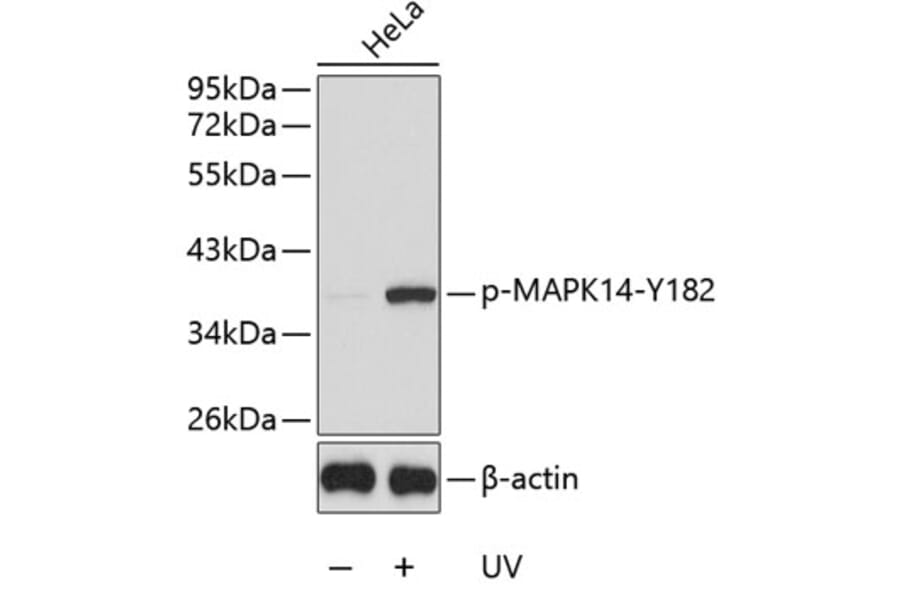 Western Blot - Anti-MAPK14 (phospho Y182) Antibody (AP0239) - Antibodies.com