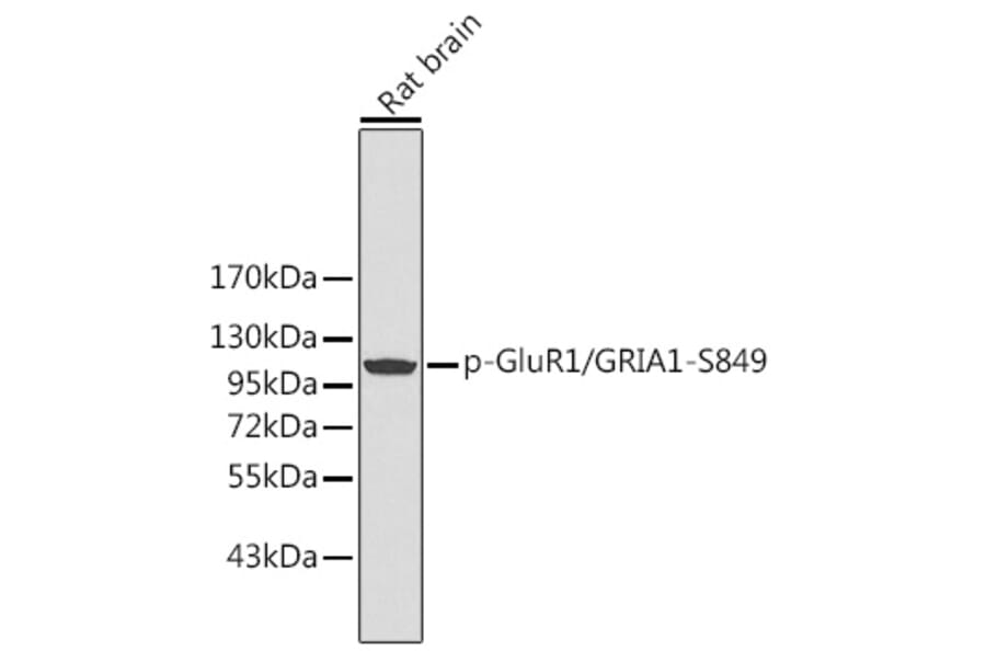 Western Blot - Anti-Glutamate Receptor 1 (AMPA subtype) (phospho Ser849) Antibody (A16539) - Antibodies.com