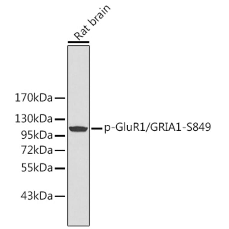Western Blot - Anti-Glutamate Receptor 1 (AMPA subtype) (phospho Ser849) Antibody (A16539) - Antibodies.com