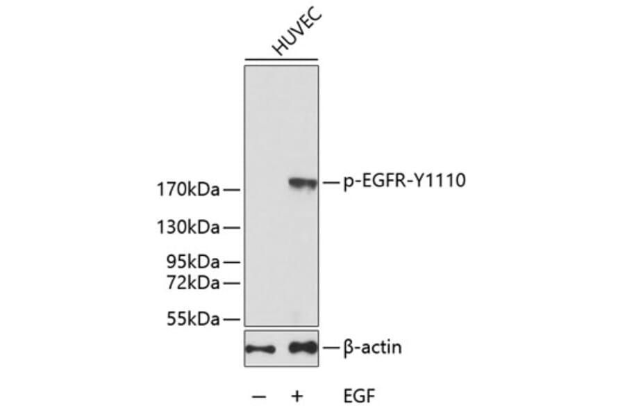 Western Blot - Anti-EGFR (phospho Y1110) Antibody (AP0243) - Antibodies.com