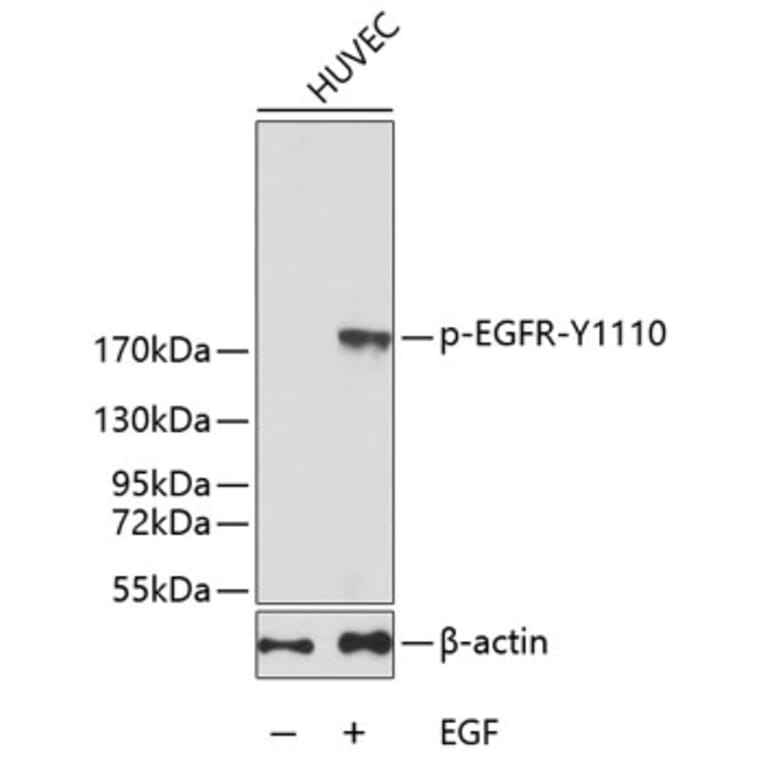 Western Blot - Anti-EGFR (phospho Y1110) Antibody (AP0243) - Antibodies.com
