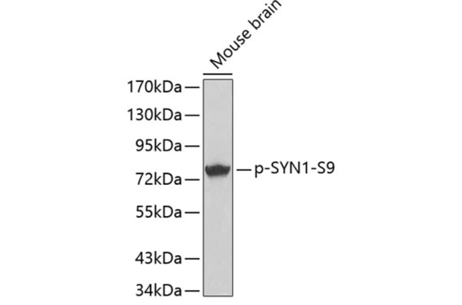 Western Blot - Anti-Synapsin I (phospho Ser9) Antibody (A16541) - Antibodies.com