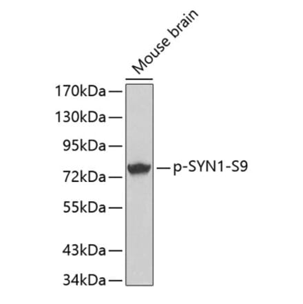 Western Blot - Anti-Synapsin I (phospho Ser9) Antibody (A16541) - Antibodies.com