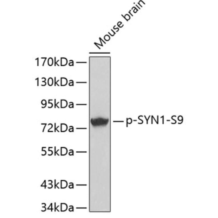 Western Blot - Anti-Synapsin I (phospho Ser9) Antibody (A16541) - Antibodies.com