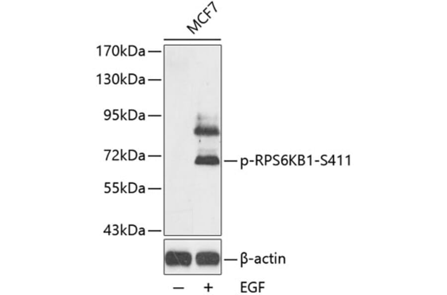 Western Blot - Anti-RPS6KB1 (phospho S411) Antibody (AP0246) - Antibodies.com