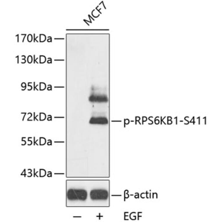 Western Blot - Anti-RPS6KB1 (phospho S411) Antibody (AP0246) - Antibodies.com