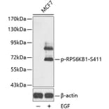 Western Blot - Anti-RPS6KB1 (phospho S411) Antibody (AP0246) - Antibodies.com