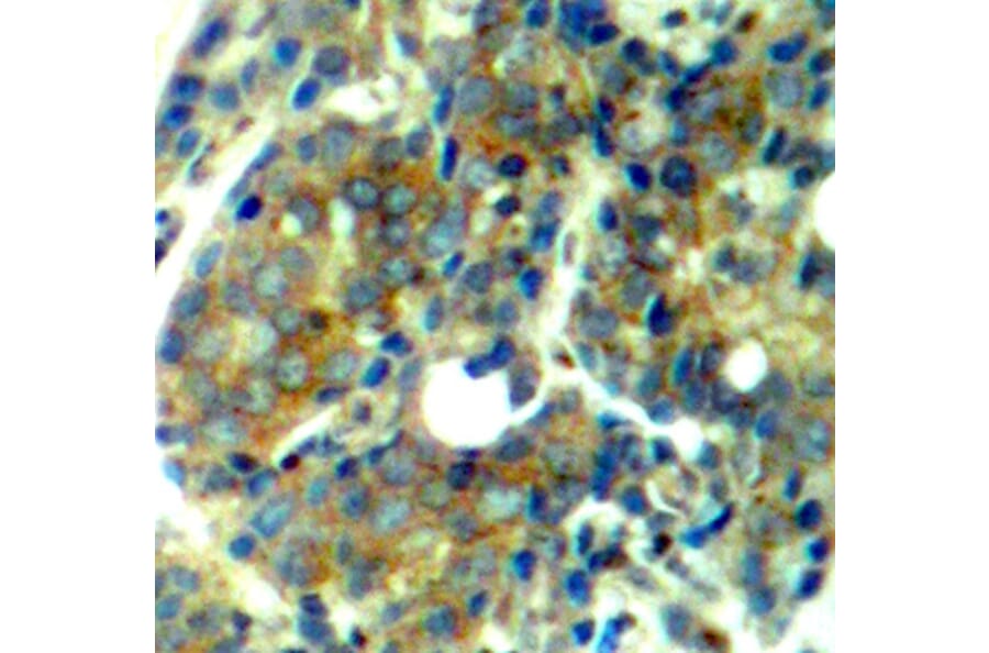Immunohistochemistry - Anti-RPS6KB1 (phospho S411) Antibody (AP0246) - Antibodies.com