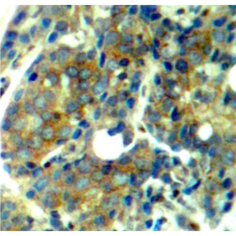 Immunohistochemistry - Anti-RPS6KB1 (phospho S411) Antibody (AP0246) - Antibodies.com