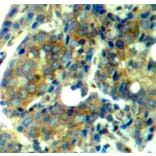 Immunohistochemistry - Anti-RPS6KB1 (phospho S411) Antibody (AP0246) - Antibodies.com