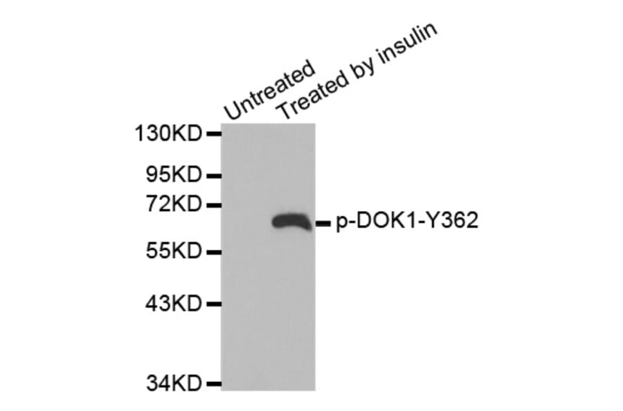 Western Blot - Anti-DOK1 (phospho Y362) Antibody (AP0248) - Antibodies.com