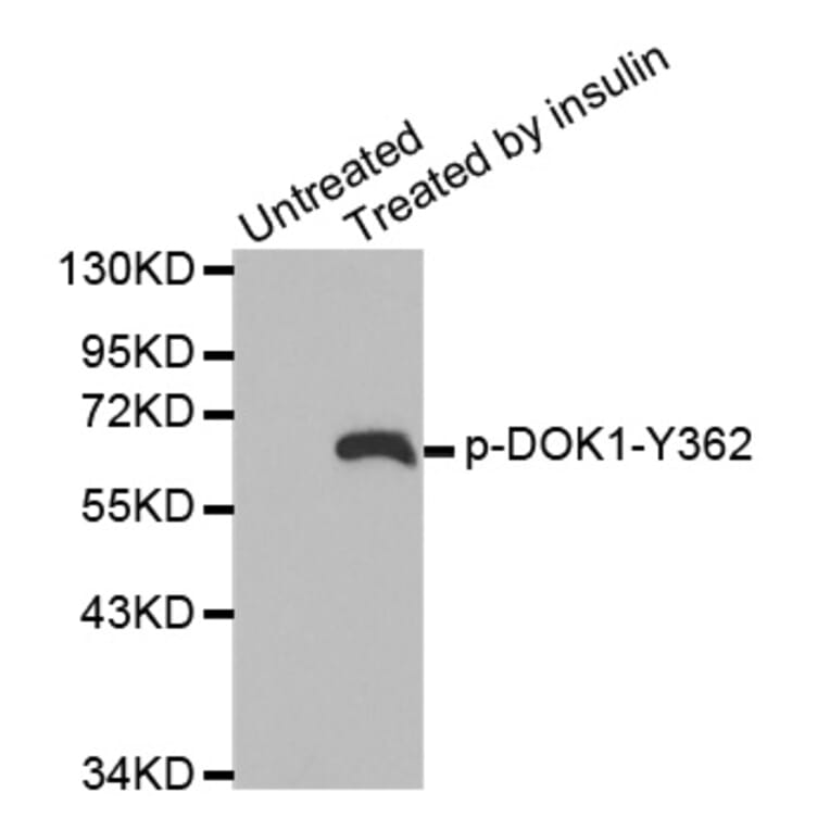 Western Blot - Anti-DOK1 (phospho Y362) Antibody (AP0248) - Antibodies.com
