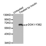 Western Blot - Anti-DOK1 (phospho Y362) Antibody (AP0248) - Antibodies.com