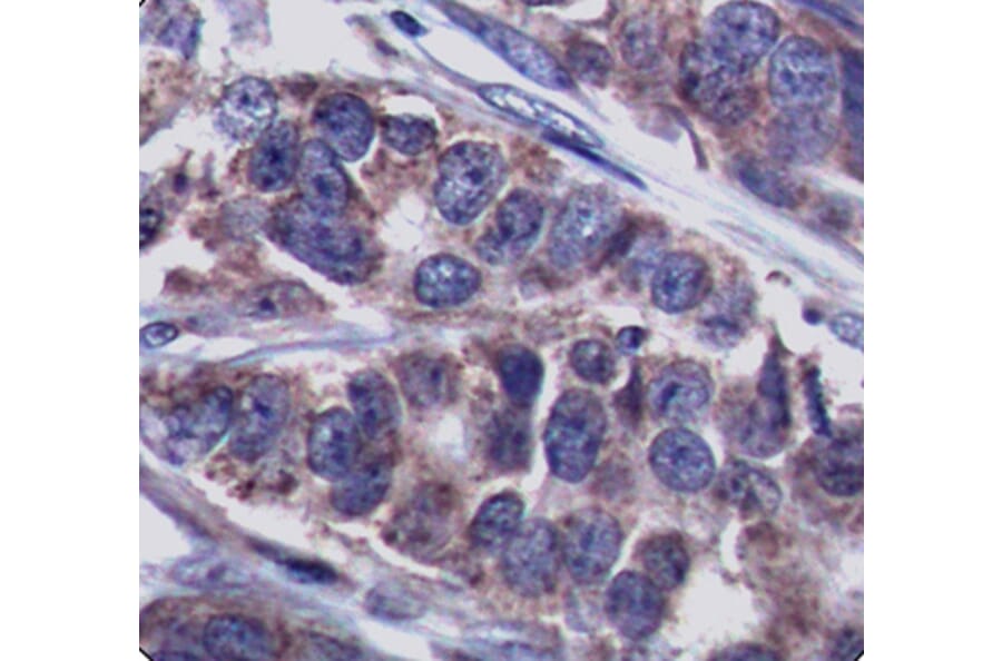 Immunohistochemistry - Anti-DOK1 (phospho Y362) Antibody (AP0248) - Antibodies.com
