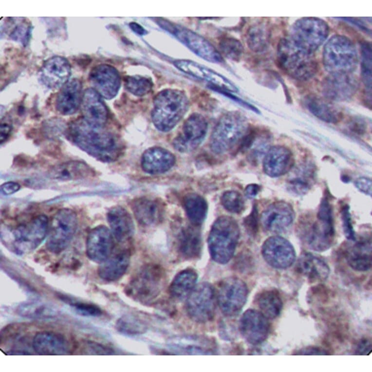 Immunohistochemistry - Anti-DOK1 (phospho Y362) Antibody (AP0248) - Antibodies.com