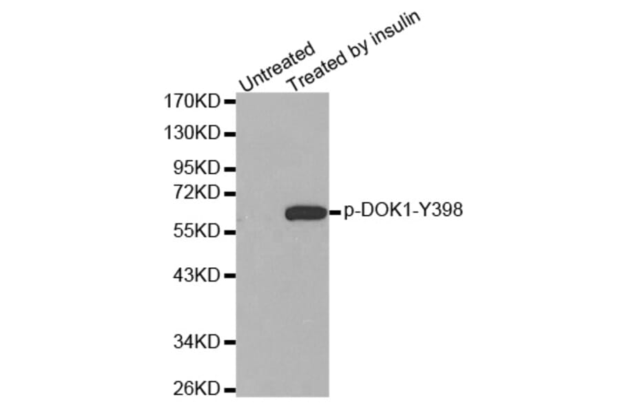 Western Blot - Anti-DOK1 (phospho Y398) Antibody (AP0249) - Antibodies.com