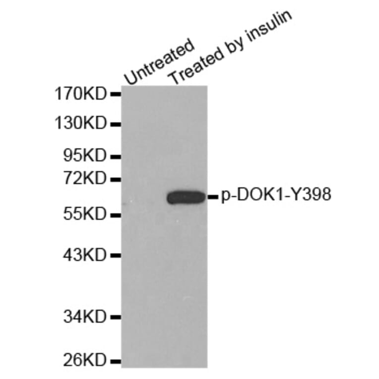 Western Blot - Anti-DOK1 (phospho Y398) Antibody (AP0249) - Antibodies.com