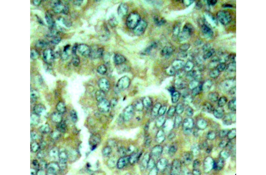 Immunohistochemistry - Anti-DOK1 (phospho Y398) Antibody (AP0249) - Antibodies.com