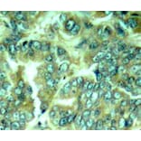 Immunohistochemistry - Anti-DOK1 (phospho Y398) Antibody (AP0249) - Antibodies.com