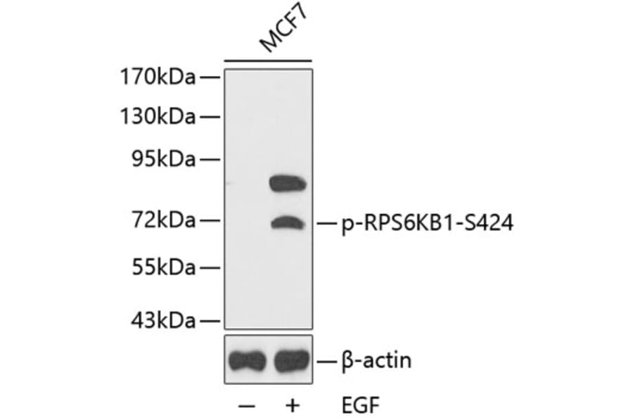 Western Blot - Anti-RPS6KB1 (phospho S424) Antibody (AP0253) - Antibodies.com