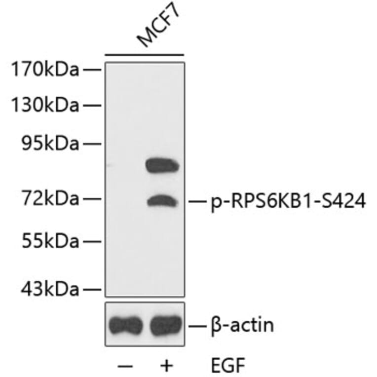 Western Blot - Anti-RPS6KB1 (phospho S424) Antibody (AP0253) - Antibodies.com