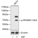 Western Blot - Anti-RPS6KB1 (phospho S424) Antibody (AP0253) - Antibodies.com