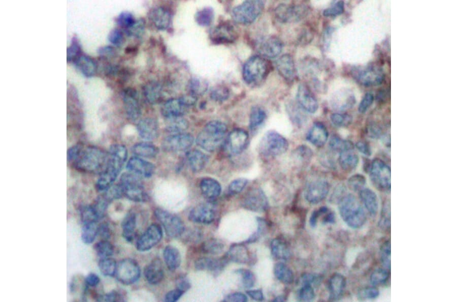 Immunohistochemistry - Anti-RPS6KB1 (phospho S424) Antibody (AP0253) - Antibodies.com
