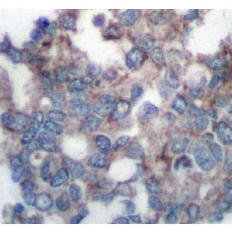 Immunohistochemistry - Anti-RPS6KB1 (phospho S424) Antibody (AP0253) - Antibodies.com