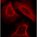 Immunofluorescence - Anti-RPS6KB1 (phospho S424) Antibody (AP0253) - Antibodies.com