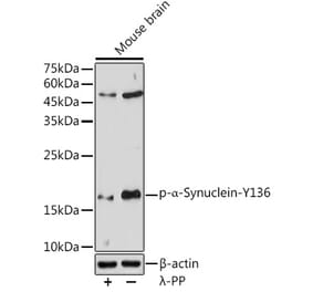 Western Blot - Anti-Alpha-synuclein (phospho Tyr136) Antibody (A16546) - Antibodies.com