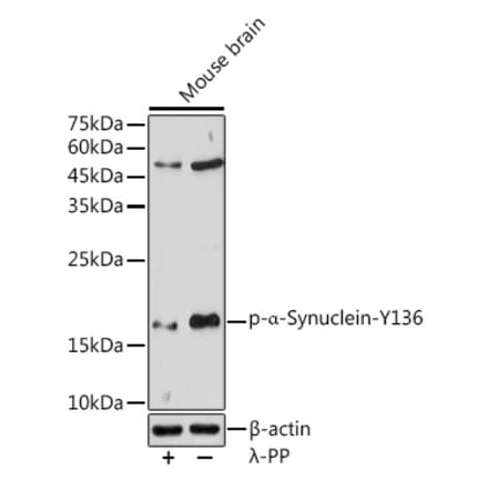 Western Blot - Anti-Alpha-synuclein (phospho Tyr136) Antibody (A16546) - Antibodies.com