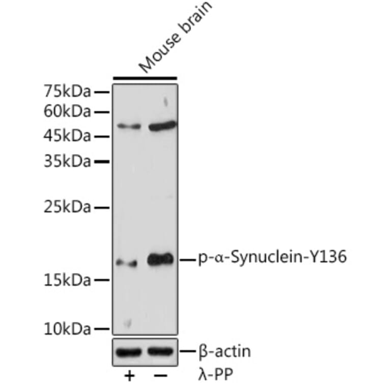 Western Blot - Anti-Alpha-synuclein (phospho Tyr136) Antibody (A16546) - Antibodies.com
