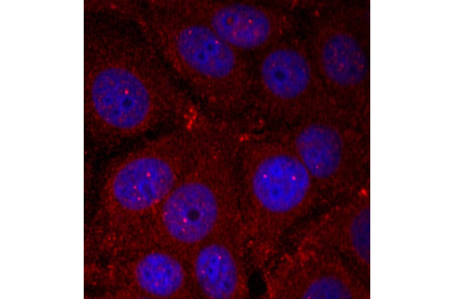 Immunofluorescence - Anti-Alpha-synuclein (phospho Tyr136) Antibody (A16546) - Antibodies.com