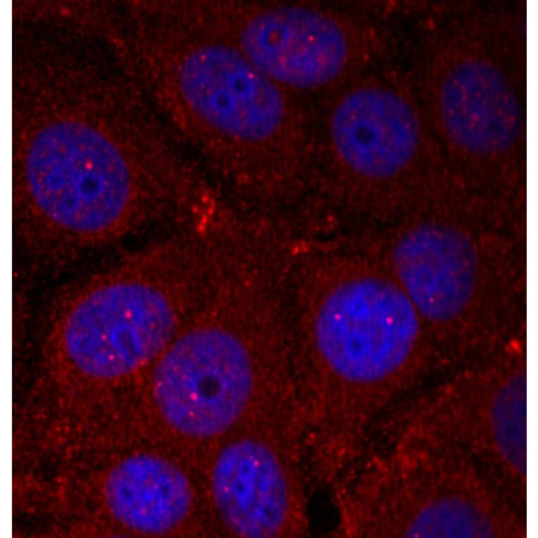 Immunofluorescence - Anti-Alpha-synuclein (phospho Tyr136) Antibody (A16546) - Antibodies.com