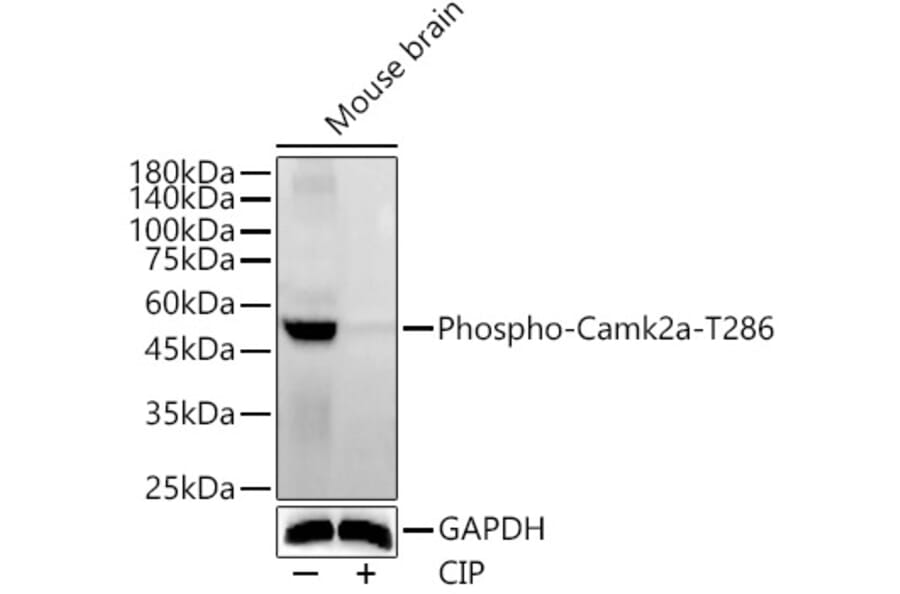 Western Blot - Anti-CaMKII alpha (phospho Thr286) Antibody (A16547) - Antibodies.com