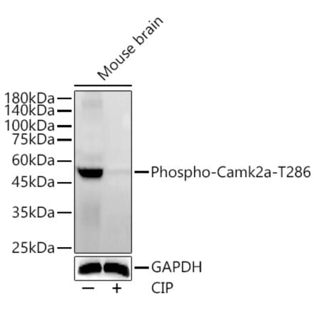Western Blot - Anti-CaMKII alpha (phospho Thr286) Antibody (A16547) - Antibodies.com