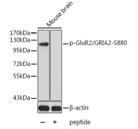 Western Blot - Anti-Ionotropic Glutamate receptor 2 (phospho Ser880) Antibody (A16548) - Antibodies.com