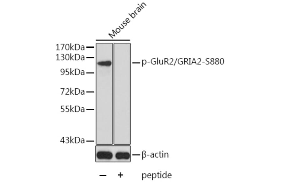 Western Blot - Anti-Ionotropic Glutamate receptor 2 (phospho Ser880) Antibody (A16548) - Antibodies.com