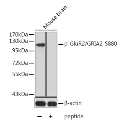 Western Blot - Anti-Ionotropic Glutamate receptor 2 (phospho Ser880) Antibody (A16548) - Antibodies.com