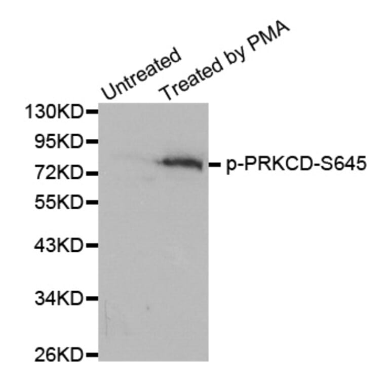 Western Blot - Anti-PRKCD (phospho S645) Antibody (AP0259) - Antibodies.com