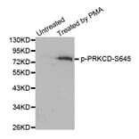 Western Blot - Anti-PRKCD (phospho S645) Antibody (AP0259) - Antibodies.com