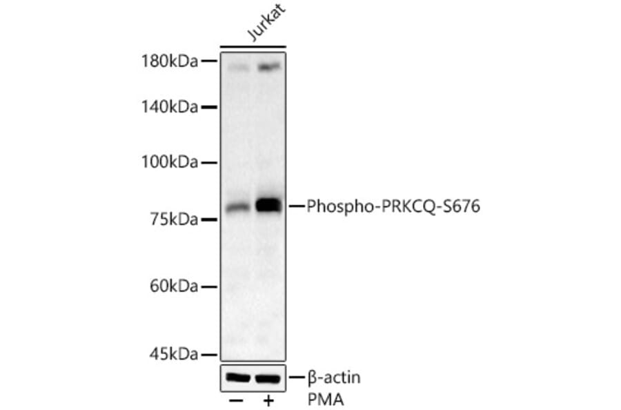 Western Blot - Anti-PKC theta/PRKCQ (phospho Ser676) Antibody (A16551) - Antibodies.com