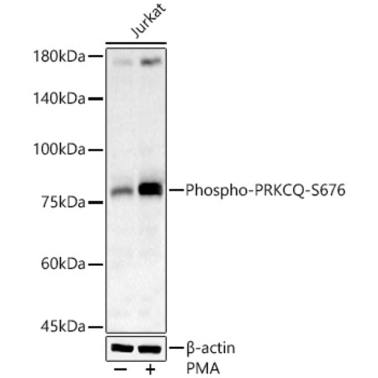 Western Blot - Anti-PKC theta/PRKCQ (phospho Ser676) Antibody (A16551) - Antibodies.com