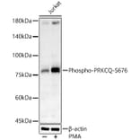 Western Blot - Anti-PKC theta/PRKCQ (phospho Ser676) Antibody (A16551) - Antibodies.com