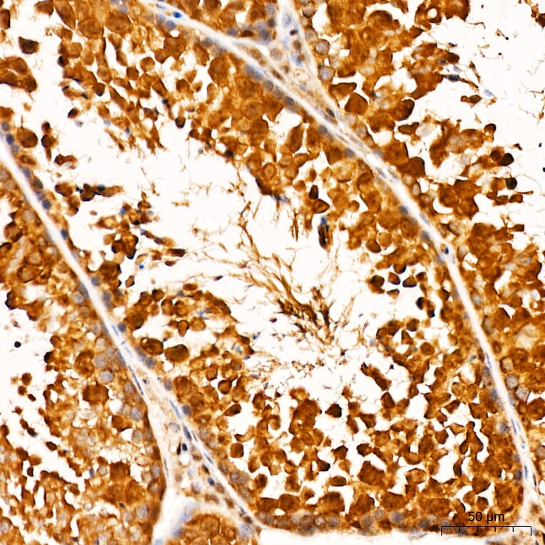 Immunohistochemistry - Anti-GSK3 beta + GSK3 alpha (Phospho Y216 & Phospho Y279) Antibody (A16552) - Antibodies.com